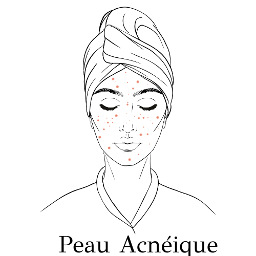 Peau Acnéique