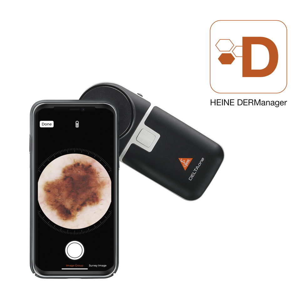 HEINE - DELTA One Dermatoscope - EDITION NOIRE